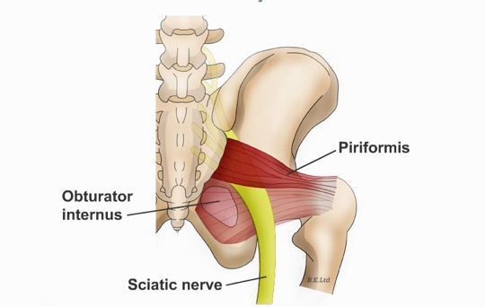 Piriformis Sendromu Galeri
